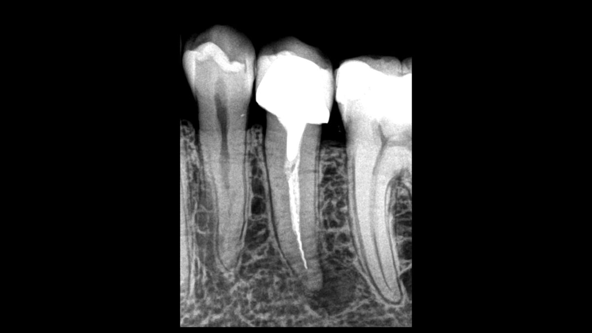 Chirurgie.001- Dr Brice Riera - Chirurgien Dentiste