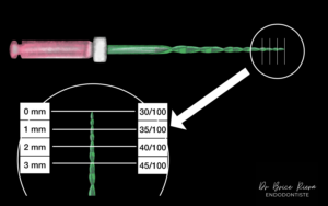 conicité-d'un-instrument-canalaire----dr-brice-riera-V2