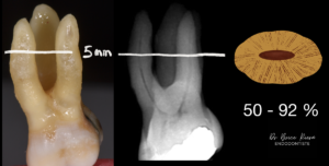 geometrie-de-section-ovale---dr-brice-riera