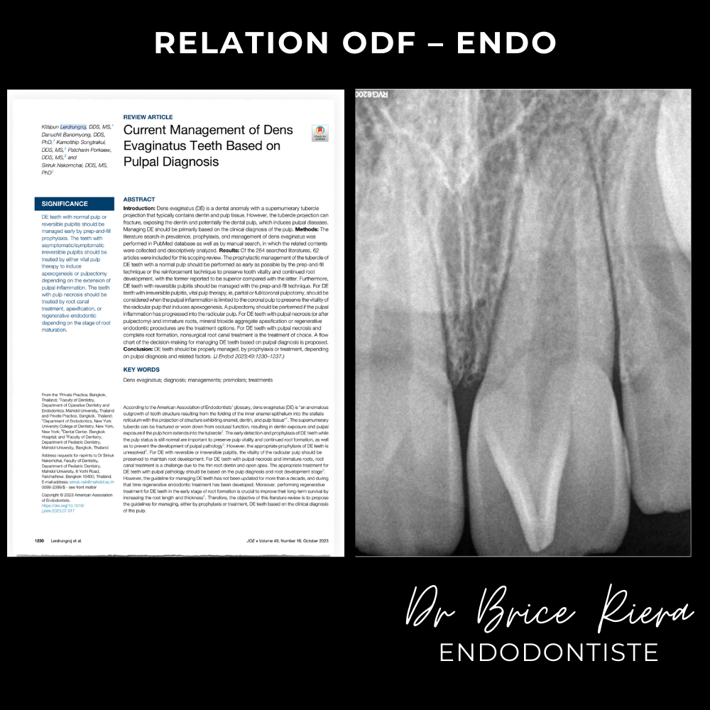 1dr Brice Riera - ODF et endodontie