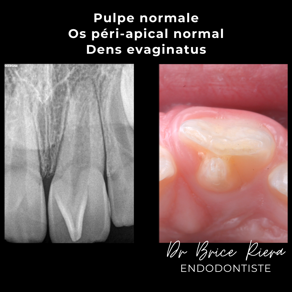 2dr Brice Riera - ODF et endodontie