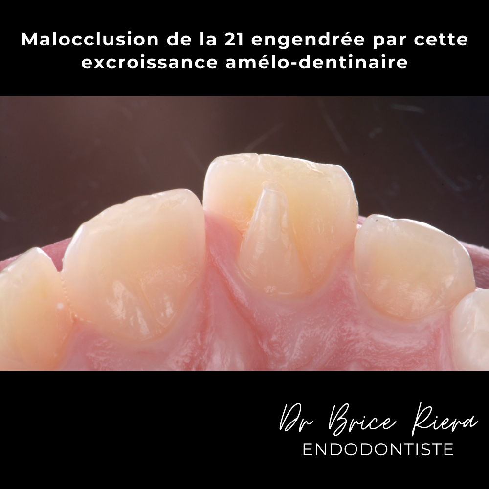 3dr Brice Riera - ODF et endodontie