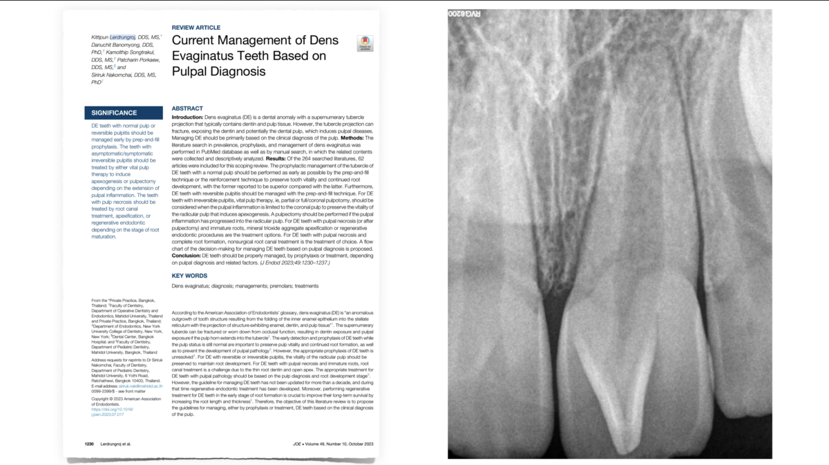 odf et endo - dr brice riera