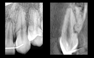 que feriez vous de cette canine - dr brice riera