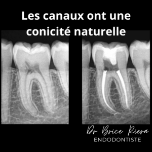 1dr Brice Riera - conicite anatomique