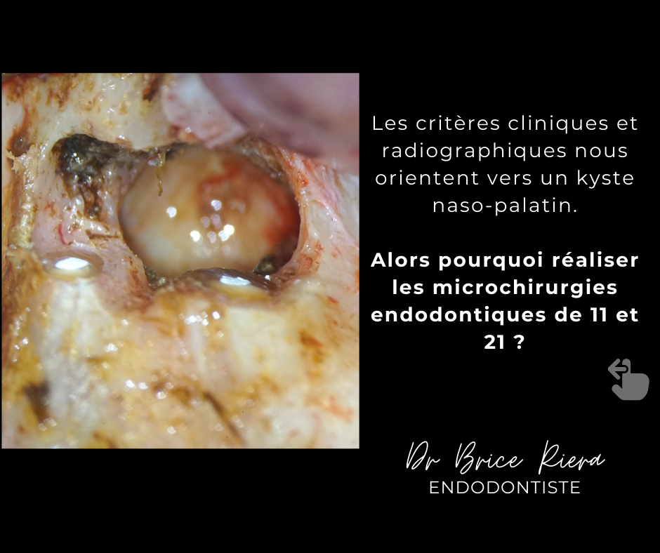 2 lesion non endodontique