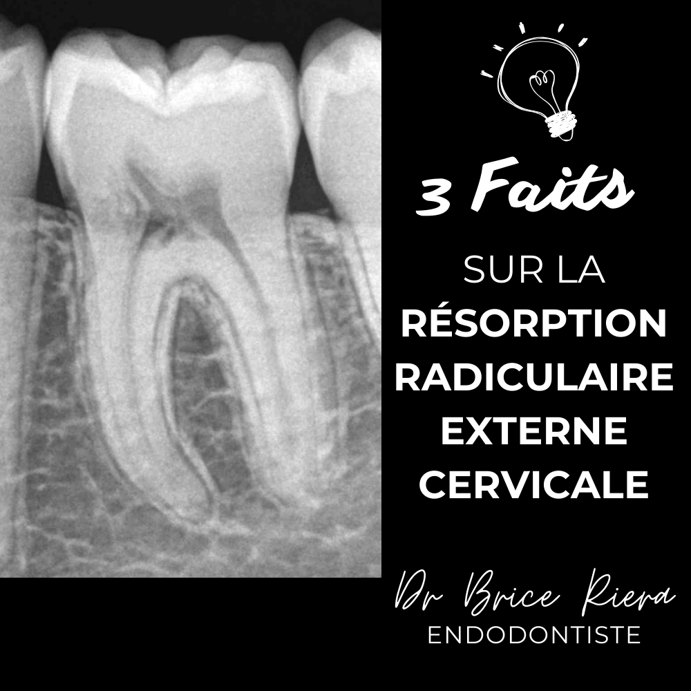 Résorption radiculaire cervicale -1