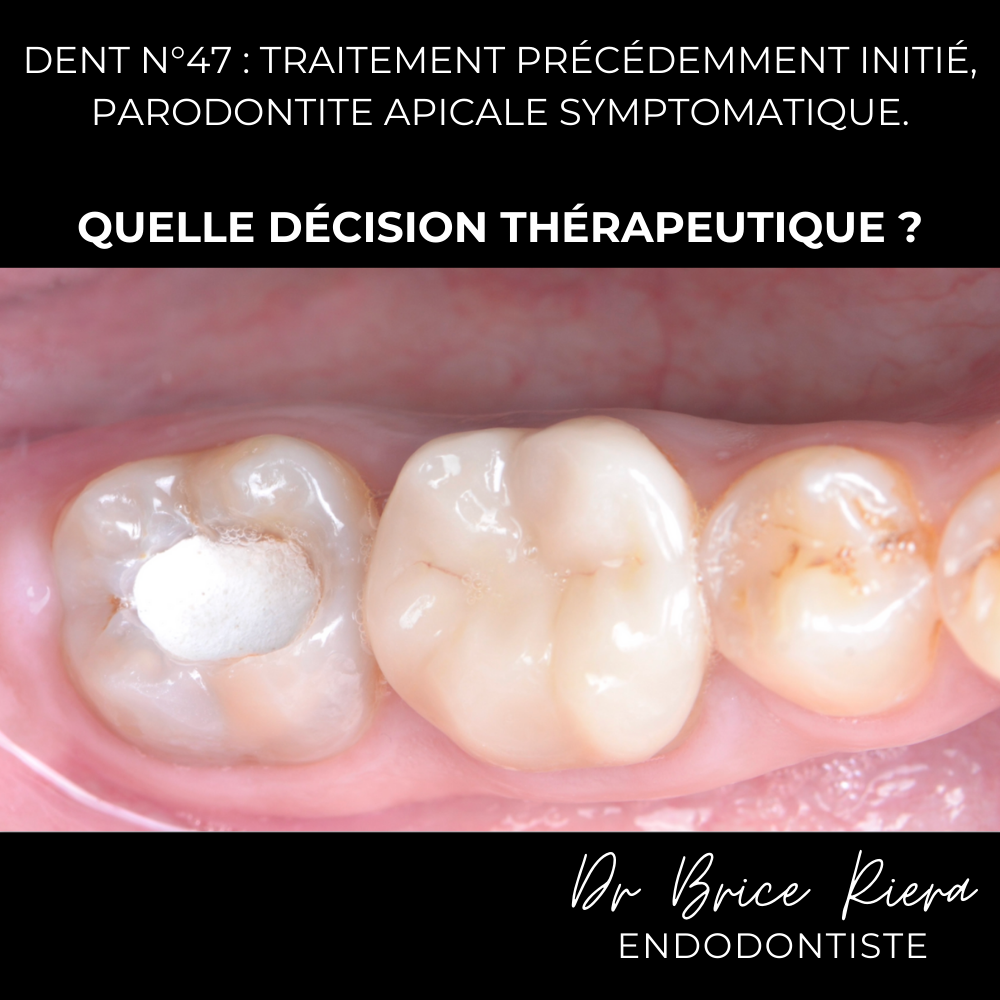 1 - - microchirurgie extra orale - dr brice riera