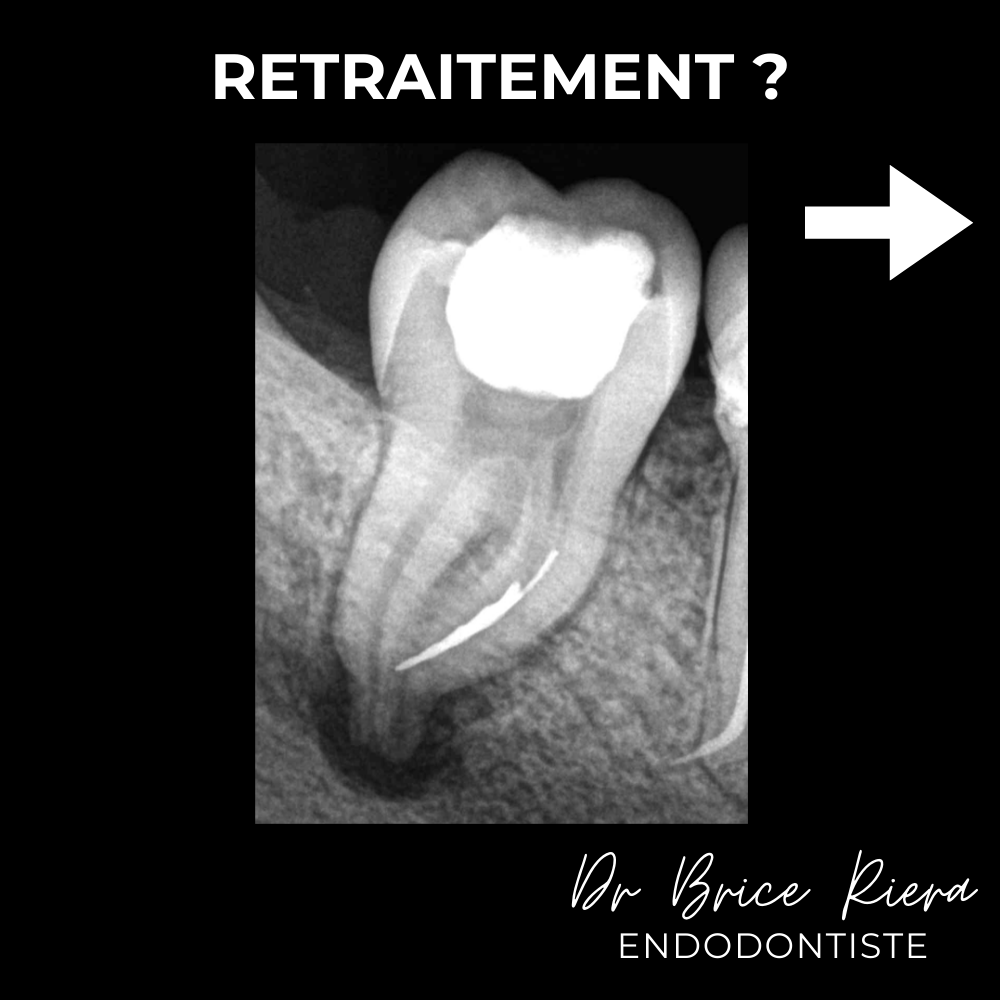 2- - microchirurgie extra orale - dr brice riera