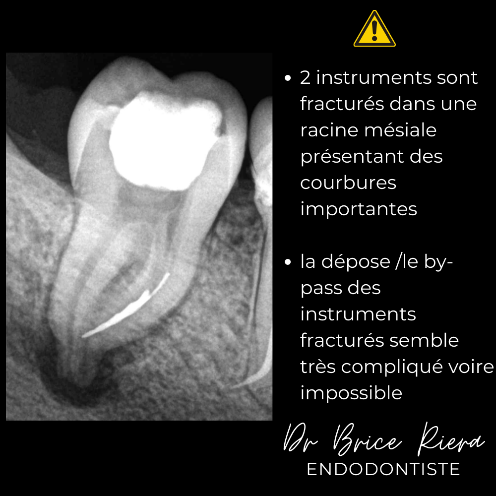 3- - microchirurgie extra orale - dr brice riera