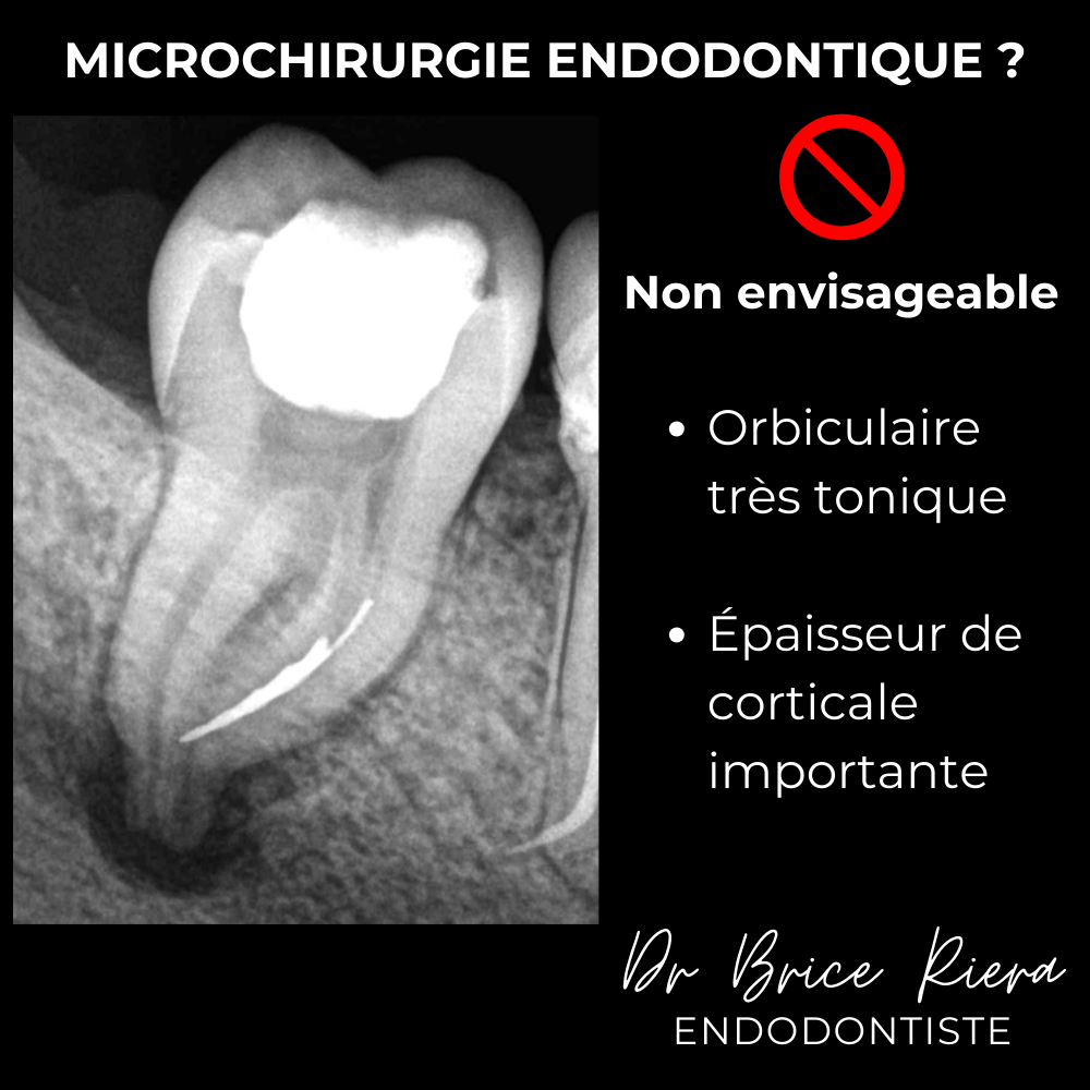 4- - microchirurgie extra orale - dr brice riera