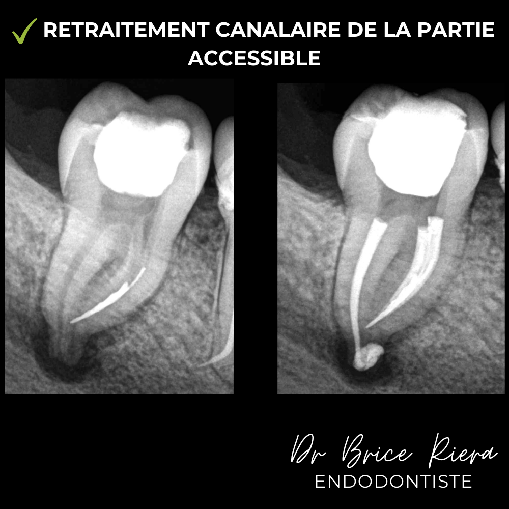 5- - microchirurgie extra orale - dr brice riera