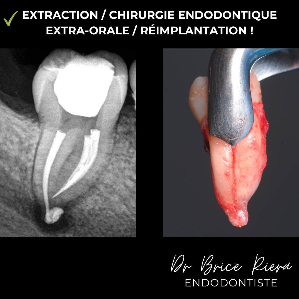 6- - microchirurgie extra orale - dr brice riera