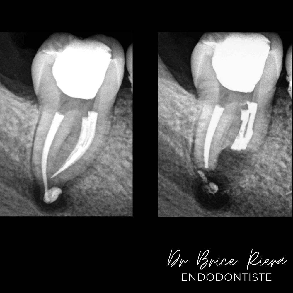 7- - microchirurgie extra orale - dr brice riera