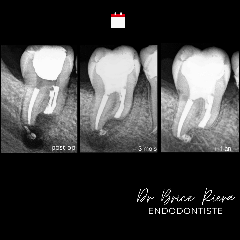 9- - microchirurgie extra orale - dr brice riera