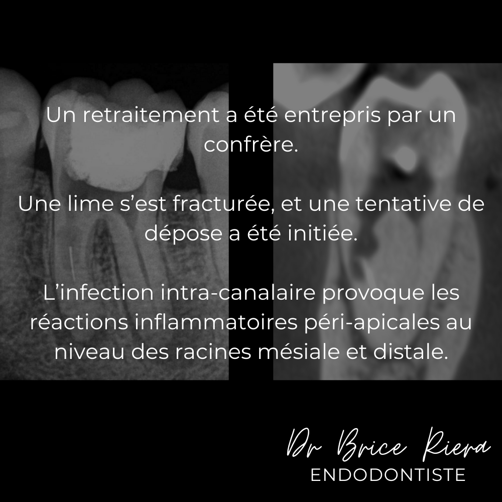 2 - Dr Brice Riera - decision therapeutique