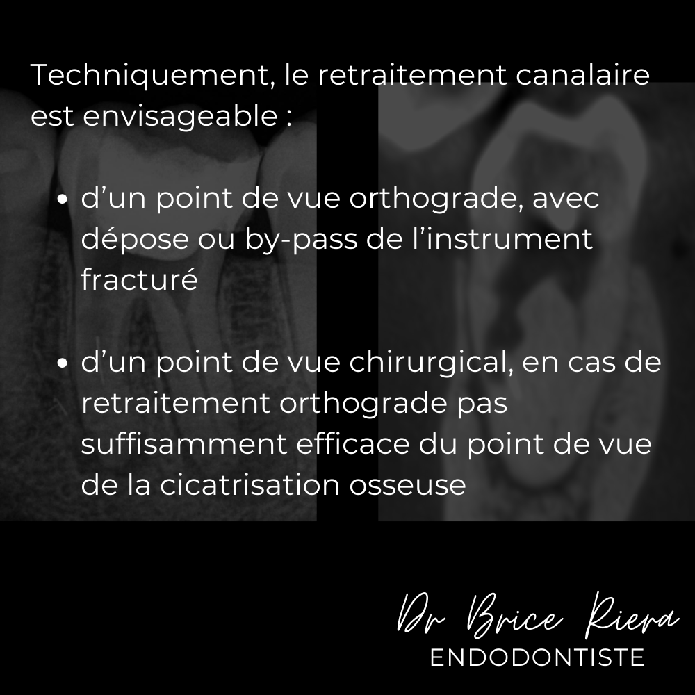 3 - Dr Brice Riera - decision therapeutique