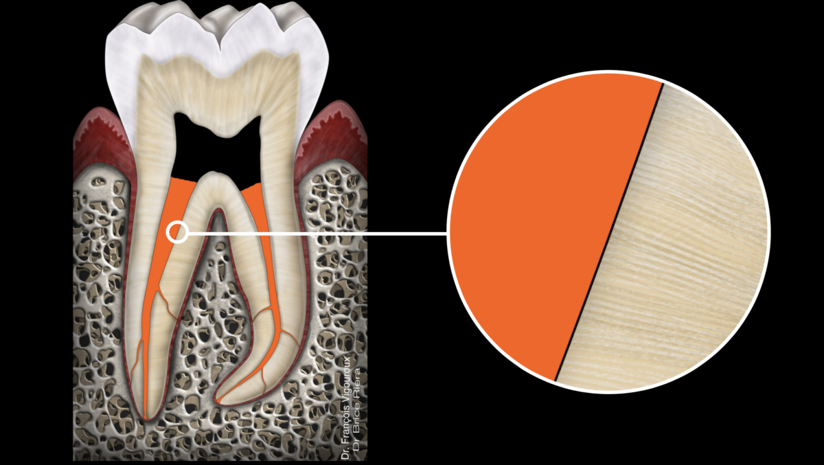 blog - Biomatériau & étanchéité - dr brice riera