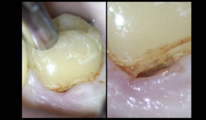 blog - quelle pathologie - Dr brice riera