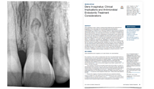 Blog - dr brice riera - diagnostic et endodontie