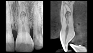 Blog - dr brice riera - mbryologie, diagnostic & endodontie