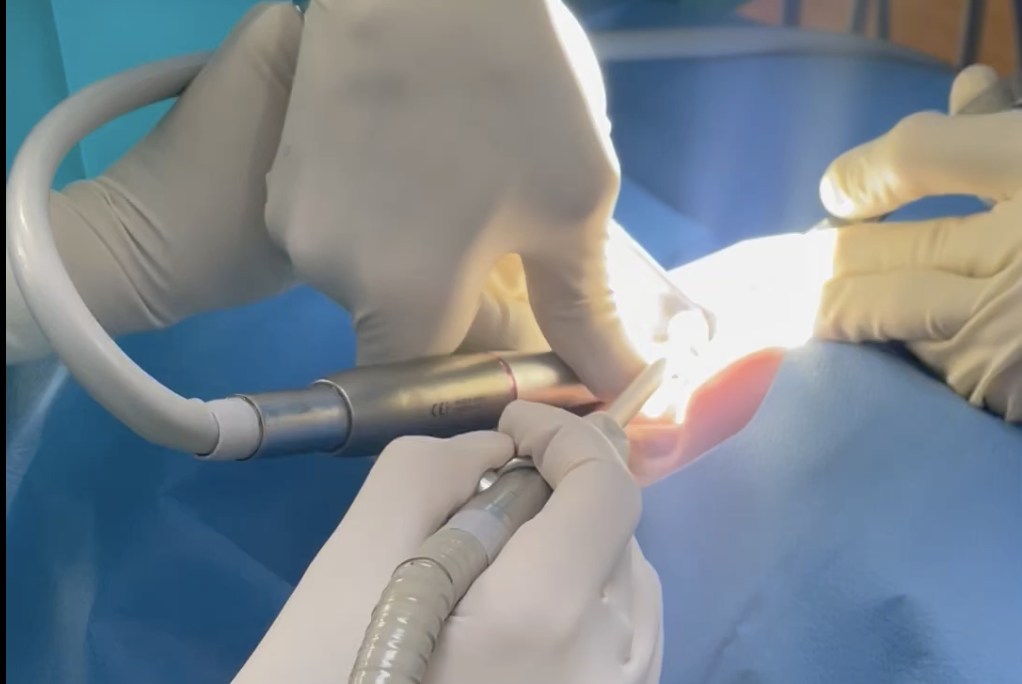 ergonomie en microchirurgie endodontique