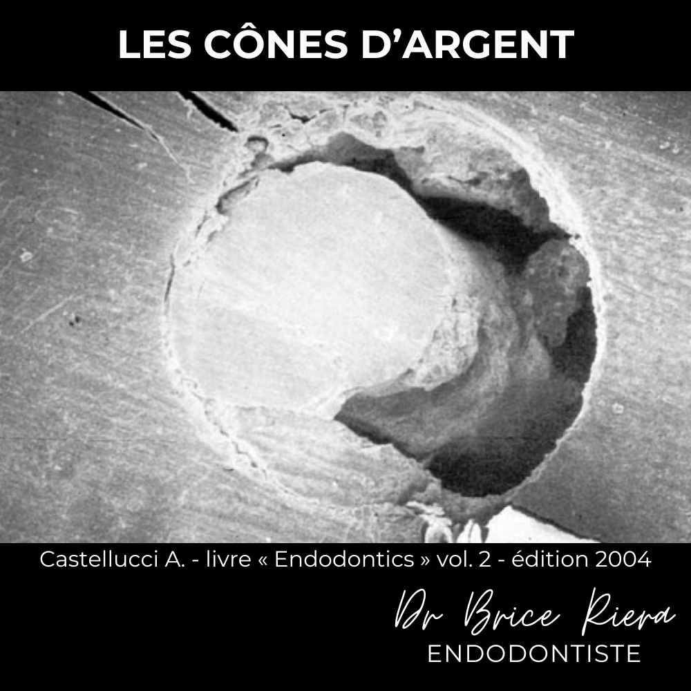 Dr Brice Riera - les cones d argent -1