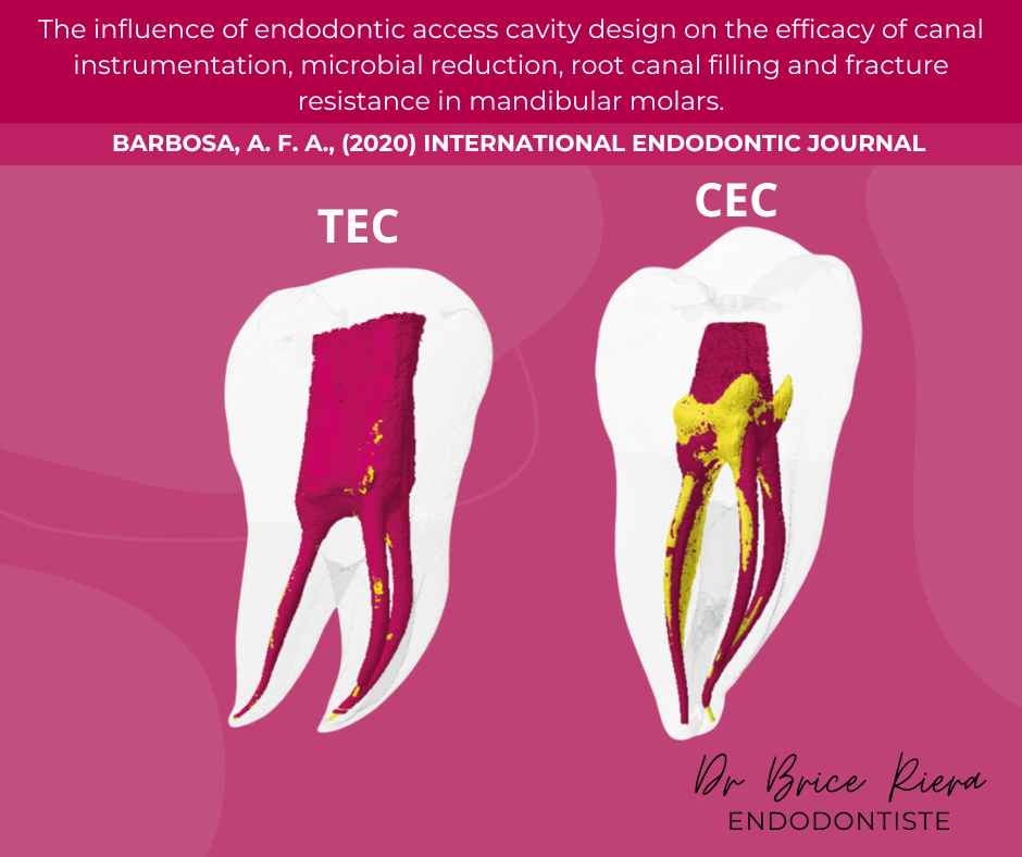 FB - visuel seul - Cavité d’accès & endodontie.