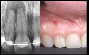 dr brice riera - diagnostic et endodontie