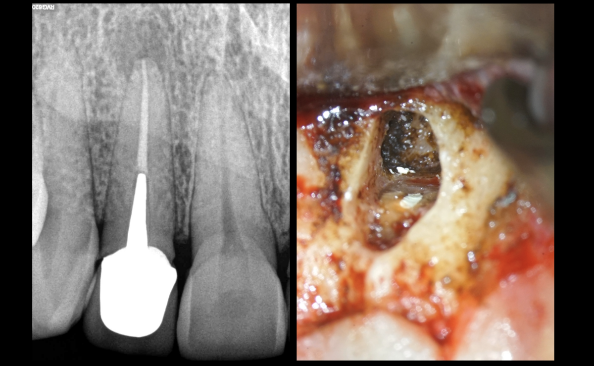 blog - dr brice riera - felicitation nouvelle endodontiste