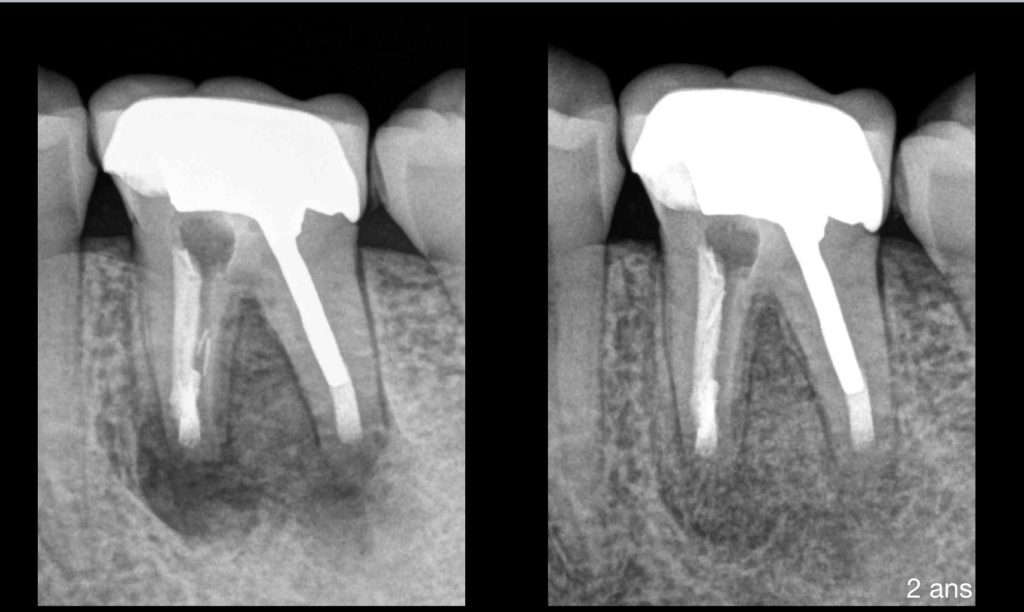 blog - dr riera - microchirurgie