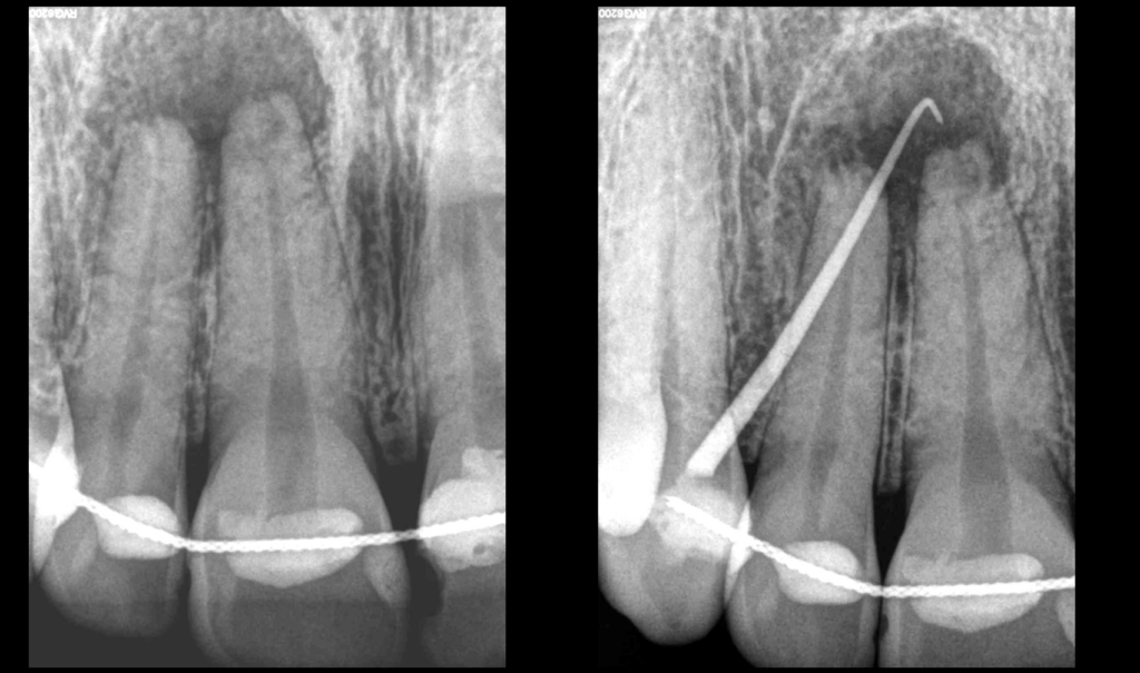 dr brice riera - diagnostic et endodontie