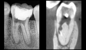 BLOG - dr brice riera - traiter ne pas traiter