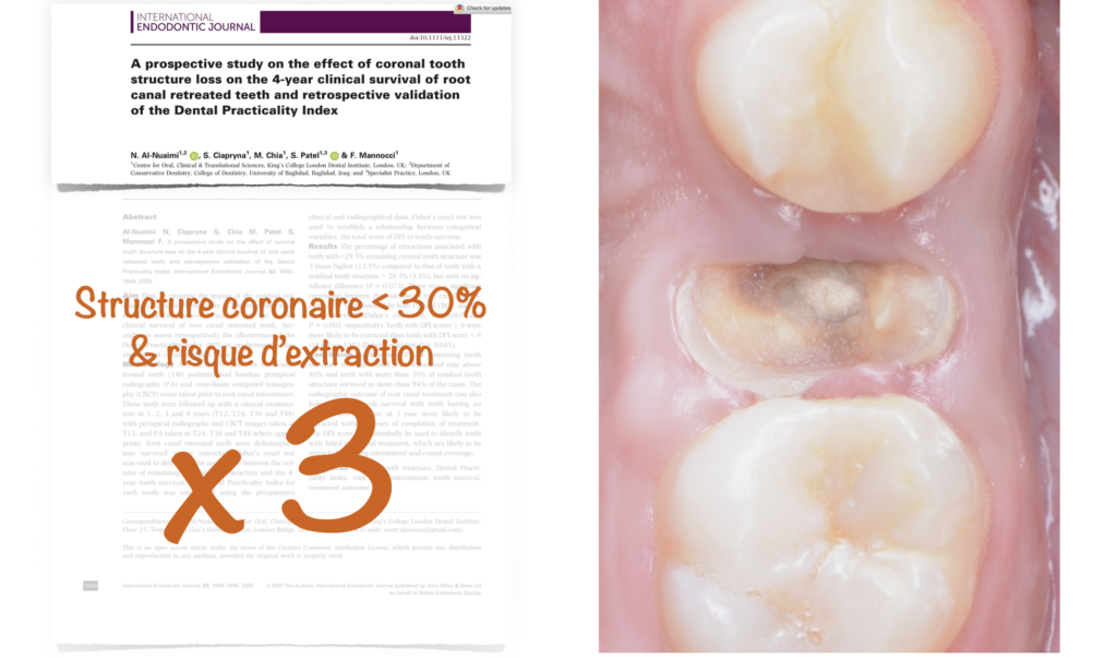 BLOG - Dr Brice Riera - diminution surface coronaire