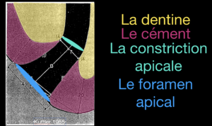 BLOG - Dr Brice Riera - distance entre anatomie apicale et constriction apicaleBLOG - Dr Brice Riera - distance entre anatomie apicale et constriction apicale