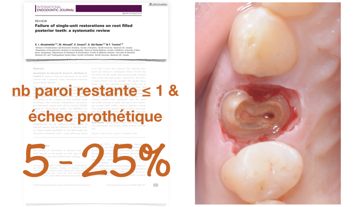 BLOG - Dr Brice Riera - paroi restante