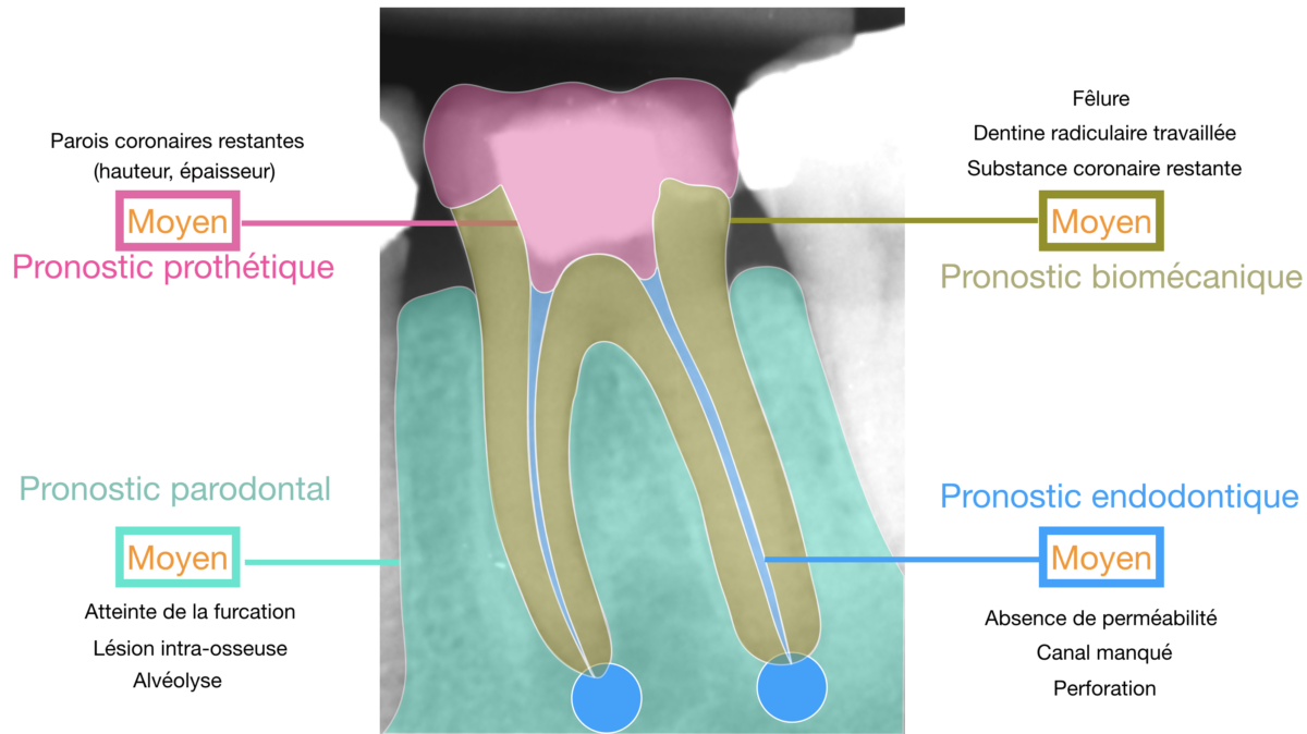 Blog - Dr Brice Riera - Facture de risques et chirurgie