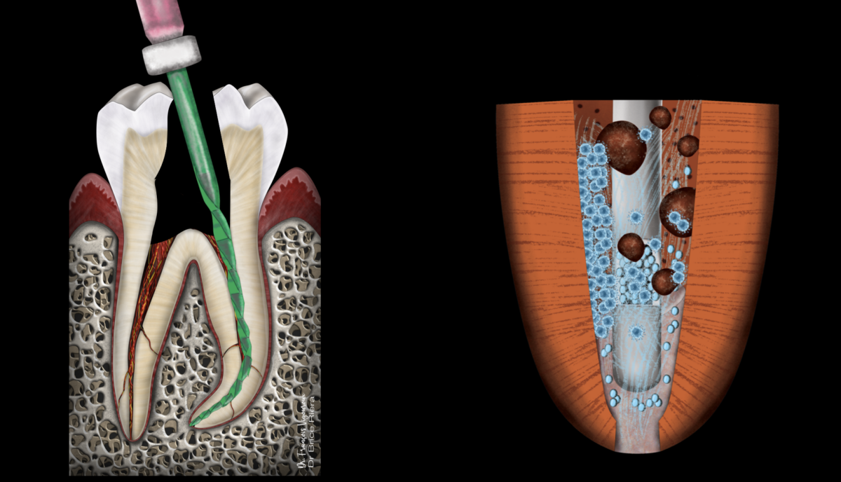 Blog - Dr Brice Riera - instrumentation