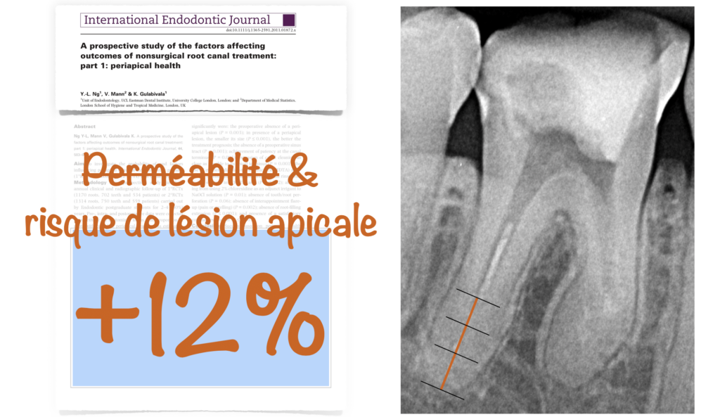 blog - dr brice riera - permeabilite et lesion apicale