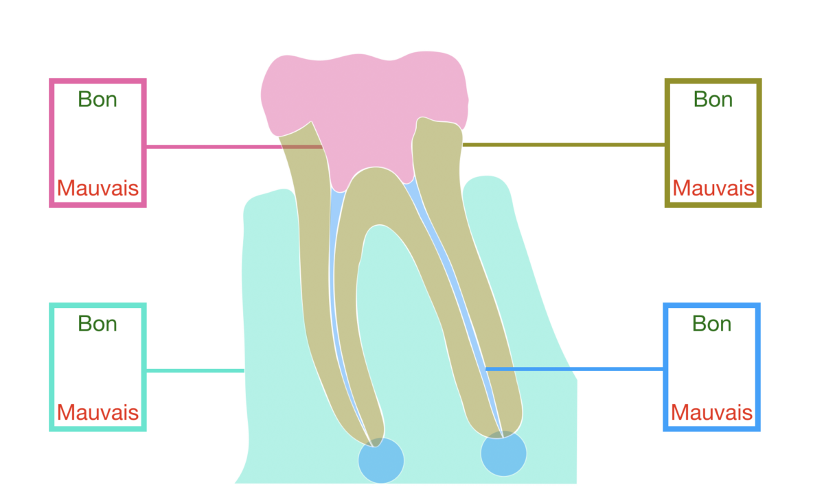 blog - dr brice riera - pronostics