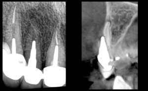 blog - dr brice riera - trompe loeil