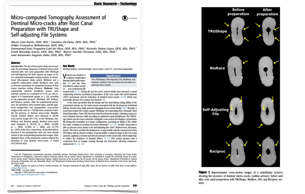 Blog - Dr Brice Riera - INstrumentation et cracks