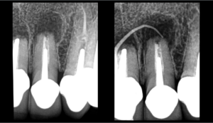 blog - dr brice riera - doit on intervenir 21