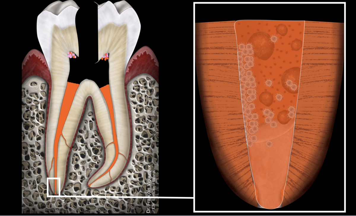 blog - dr brice riera - radiographie alveolaire