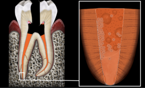 blog - dr brice riera - radiographie alveolaire