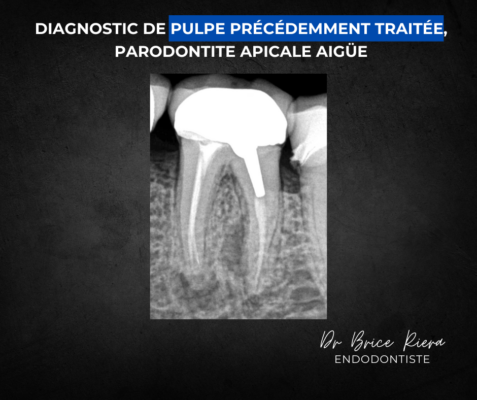 Dr Brice Riera Endodontiste