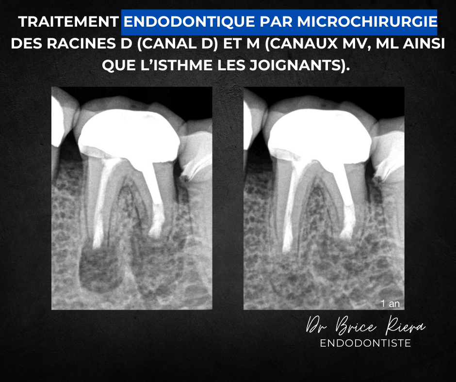 Dr Brice Riera Endodontiste