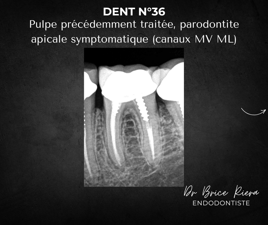 Blog - Dr Brice Riera - dent 36