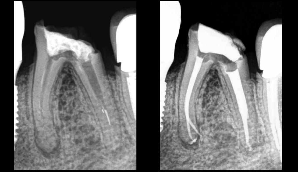 BLOG - Dr Brice Riera - on se bat pour la dent