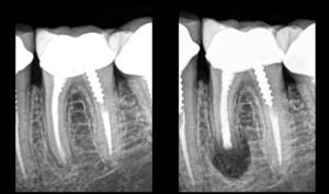 Blog - Dr Brice Riera - dent 36